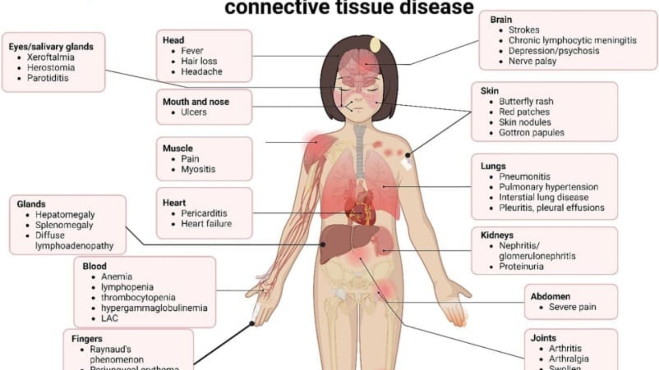 Common Disorders of Tissues (1)