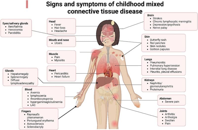 Common Disorders of Tissues (1)