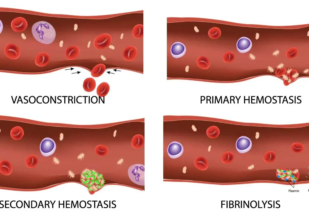 Platelets and Hemostasis