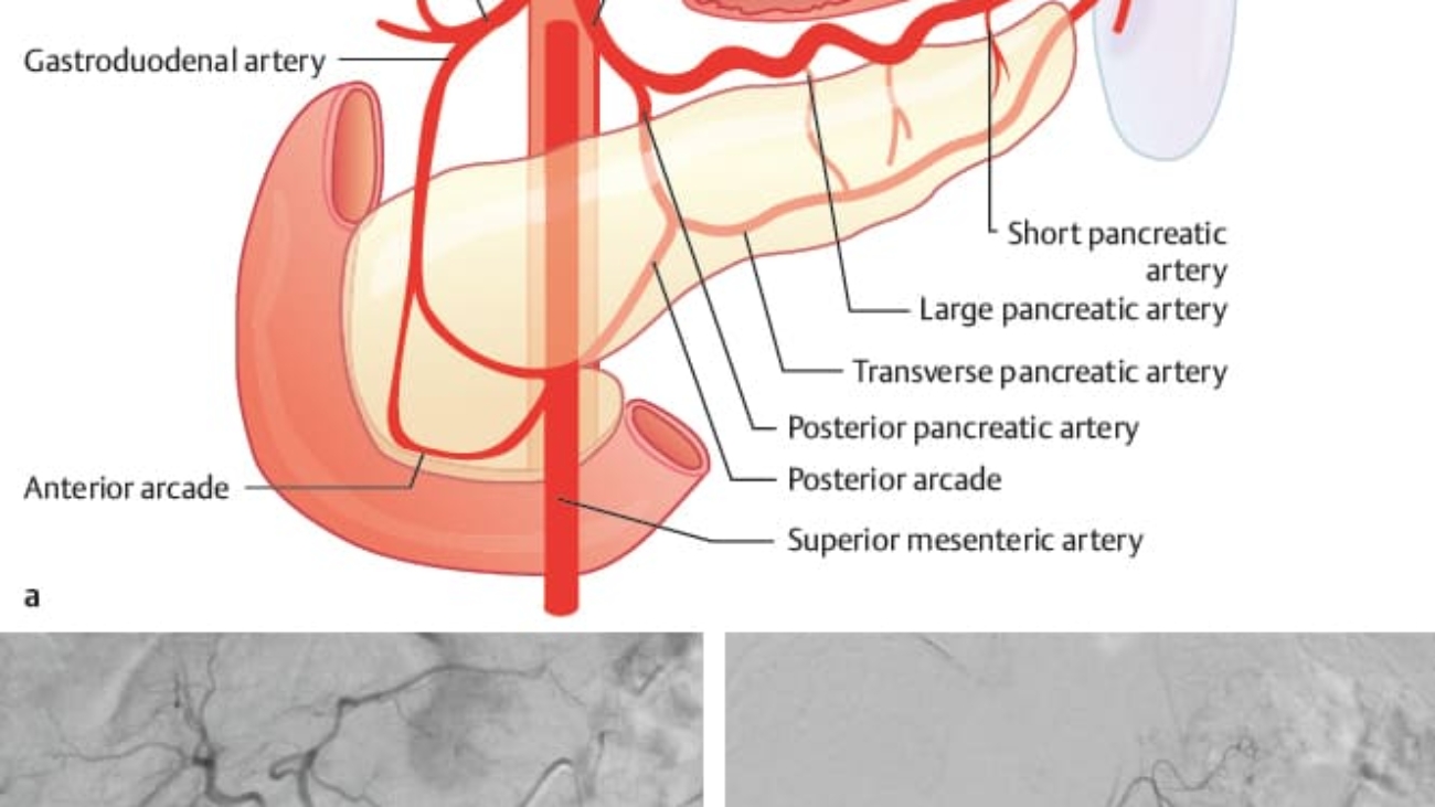 Blood Supply Pancreas (1)