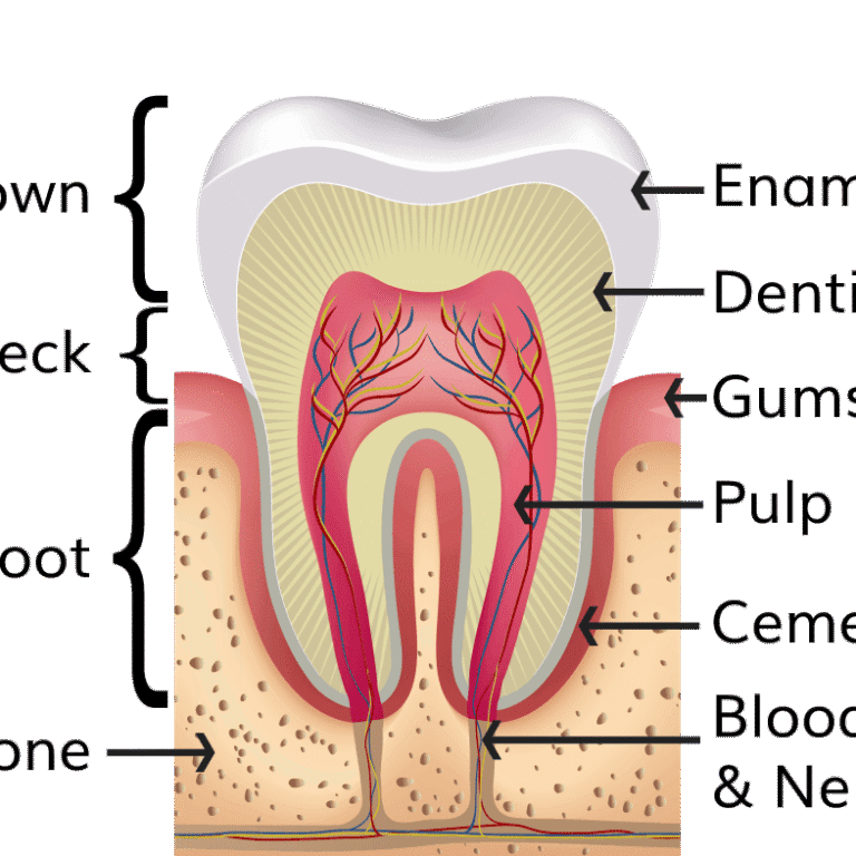 Dental Caries and Its Complications: Diagnosis and Management