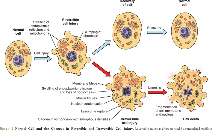 Cell Injury & Death