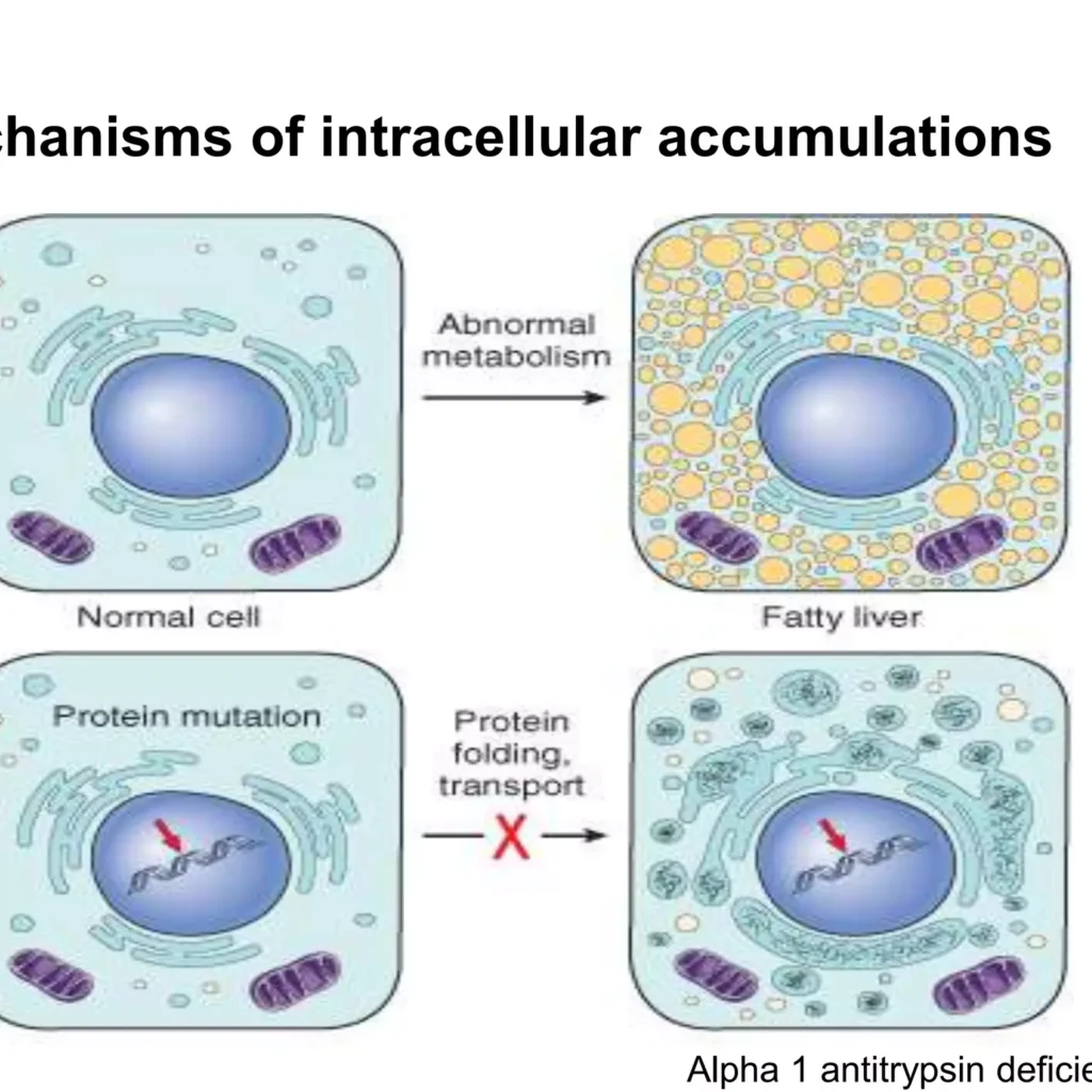 intracellular accumulation