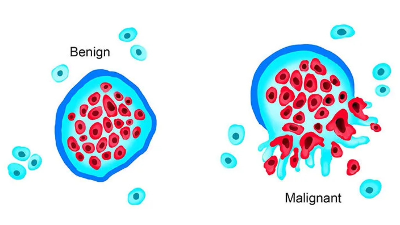 Neoplasia & Oncology