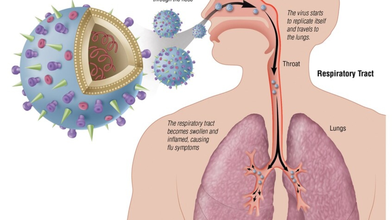 Upper Respiratory Tract Infections (URTIs) (1)