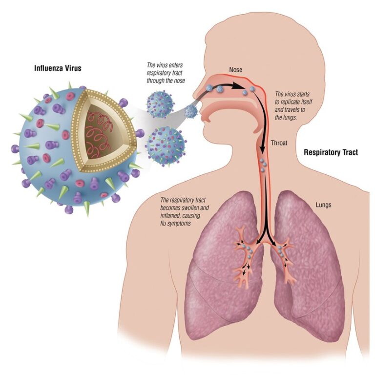 Lower Respiratory SystemInfections (LRTI)