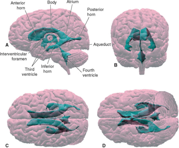 3D morphological view of the lateral, 3rd, and 4th ventricles showing their relationships