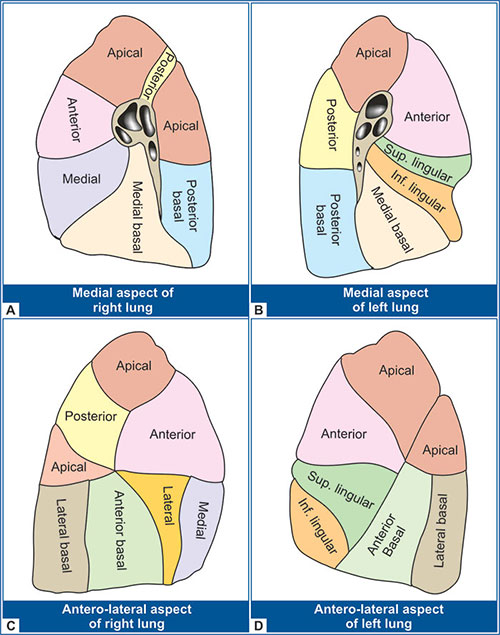 Color-coded diagram of the bronchopulmonary segments in the right and left lungs