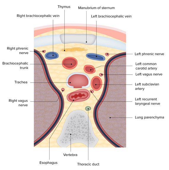 Transverse section at T4 showing the Sternum, Thymus, Aorta, SVC, Trachea, Esophagus, and Nerves