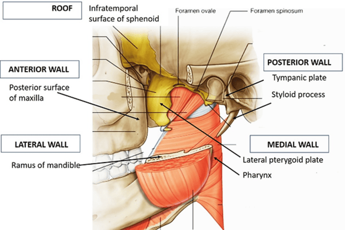 Diagram detailing the boundaries of the infratemporal fossa
