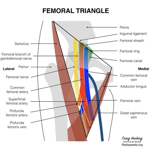 [Image Placeholder: The Femoral Triangle and Sheath Structure. Upper anterior thigh diagram showing NAVEL arrangement and the femoral sheath enveloping the artery and vein but excluding the nerve.]