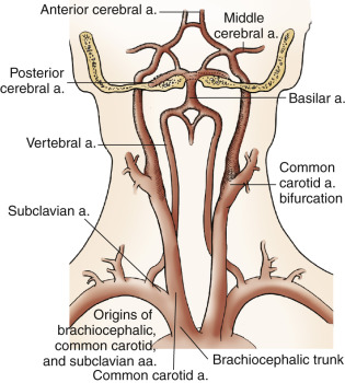 [IMAGE PLACEHOLDER: Diagram showing the origin of the common carotid arteries. The right common carotid branching from the brachiocephalic trunk, and the left common carotid branching directly from the aortic arch.]