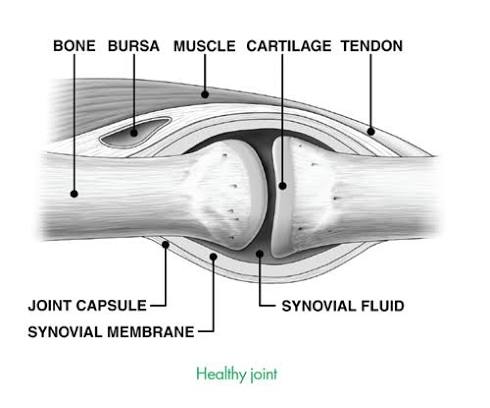 Figure 1: Anatomy of a healthy synovial joint showing bone, bursa, muscle, cartilage, tendon, and synovial membrane/fluid