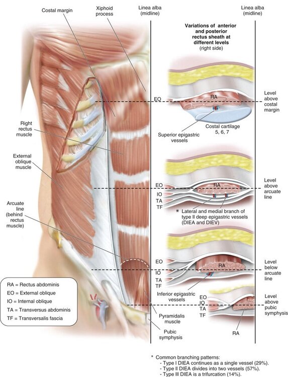 Figure 5.1: Anterior view of the abdominal wall showing the arterial supply and variations of the rectus sheath