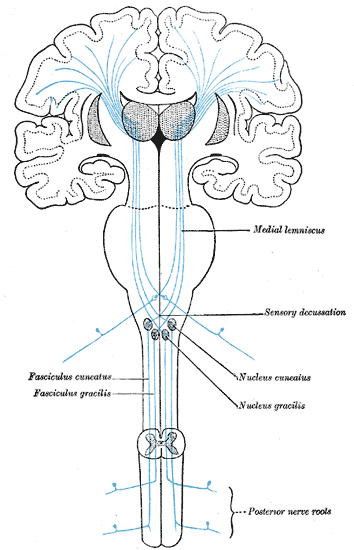Figure 4: Classic anatomical illustration of DCML showing sensory decussation in medulla