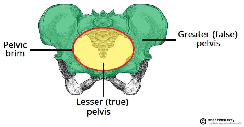 Coronal section showing the greater (false) pelvis and lesser (true) pelvis separated by the pelvic brim