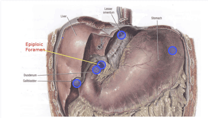 Figure 4.2: Epiploic Foramen of Winslow — Detailed boundaries illustration