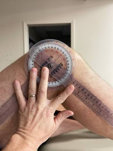Figure 4.1: Goniometric assessment of knee ROM using a protractor-like instrument