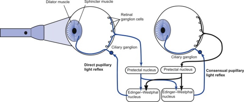 Figure 7 & 8: Neural pathway of the pupillary light reflex showing consensual response