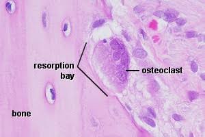 Figure 1.6 — Osteoclast in Resorption Bay (H&E stain)