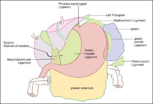 Figure 3.3: Peritoneal Ligaments — Stomach View — Anterior view showing gastrophrenic, gastrosplenic, and gastrocolic ligaments. The greater omentum is visible as the apron-like structure