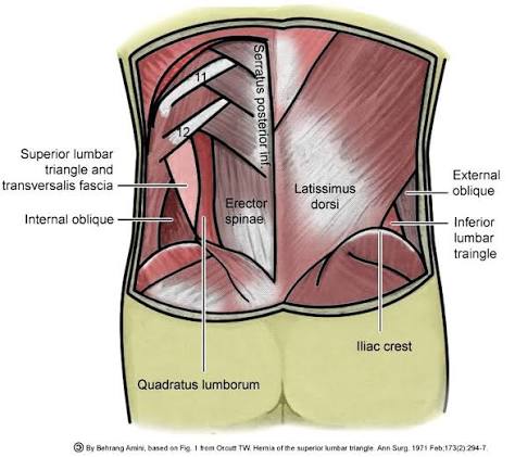 Figure: Posterior view showing the superior and inferior lumbar triangles (Grynfeltt-Lesshaft and Petit). Note boundaries formed by latissimus dorsi, external oblique, and iliac crest