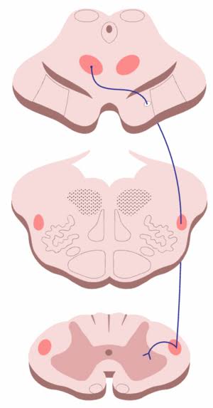 Figure 20: Rubrospinal tract — ventral tegmental decussation and spinal cord termination