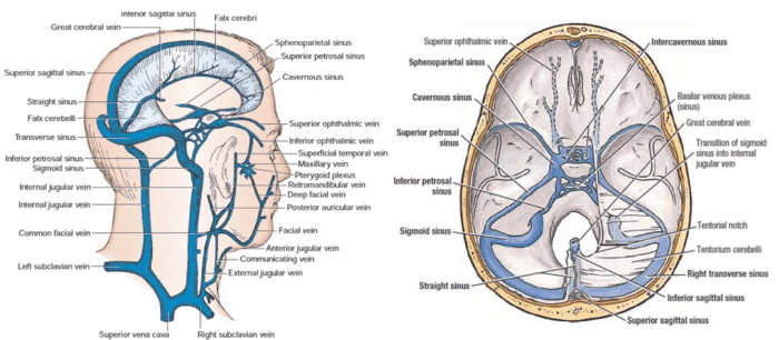 Diagram: Sagittal view of the dural venous sinuses and coronal view of the cavernous sinus
