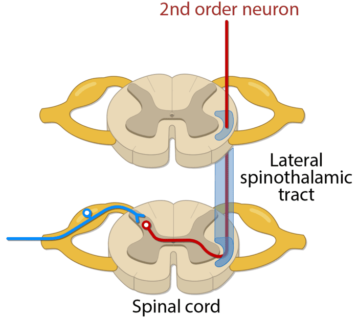 Figure 7: Spinothalamic tract decussation through anterior white commissure