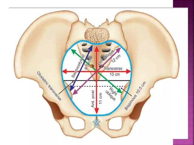 Superior view of the pelvic inlet showing all obstetric diameters