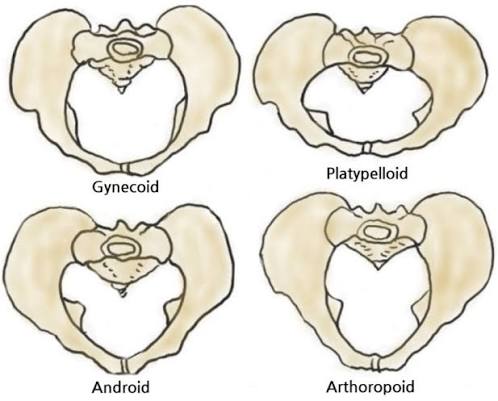 The four Caldwell-Moloy pelvic types with their characteristic inlet shapes