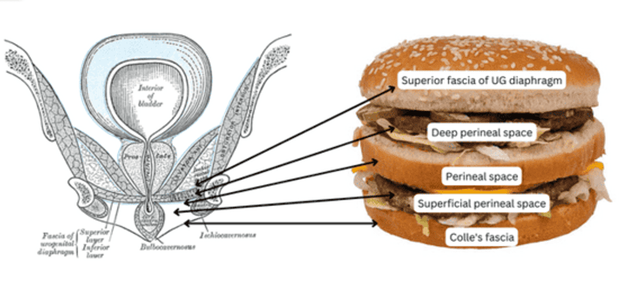 Figure 2.2 - The 'burger' analogy for perineal spaces: superior fascia (top bun), deep perineal space (meat), perineal membrane (middle bun), superficial perineal space (meat), and Colles' fascia (bottom bun)