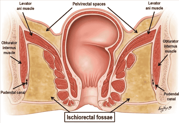 Figure 4.2 - Coronal section showing the ischioanal fossae (fat-filled spaces) flanking the anal canal, with the pudendal canal (Alcock's) on the lateral wall