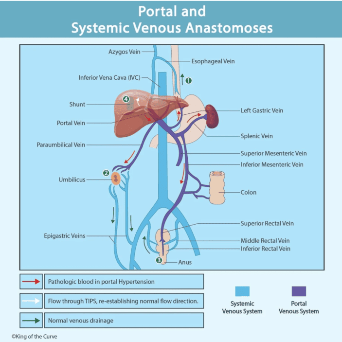 Figure 6.3: Portal and Systemic Venous Anastomoses