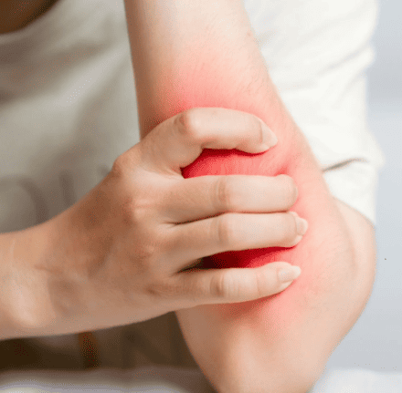 Muscle disorders (Myositis, Strain, Paralysis)