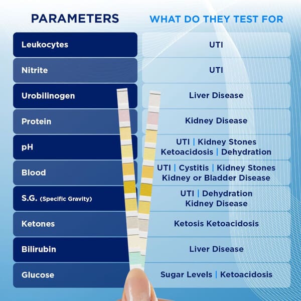 Figure 3: Urinalysis dipstick parameters including Leukocytes, Nitrite, pH, Protein, Glucose, Ketones, Urobilinogen, Bilirubin, Blood, and Specific Gravity
