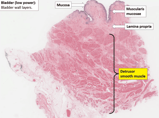 Figure 6: Bladder Normal Histology (Low Power) showing mucosa, lamina propria, and thick detrusor layer