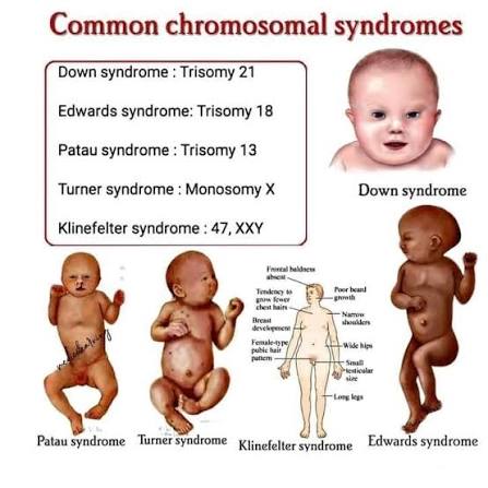 Chromosomal Abnormalities