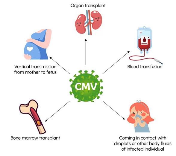 Cytomegalovirus