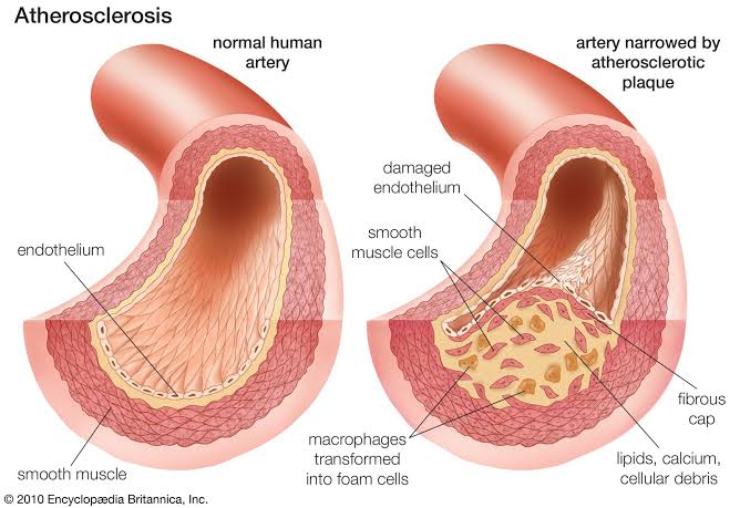 Disorders of blood circulation (Heart failure, Arteriosclerosis)