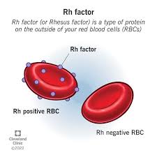 Figure: Rh factor showing Rh-positive RBCs with D antigen and Rh-negative RBCs lacking D antigen