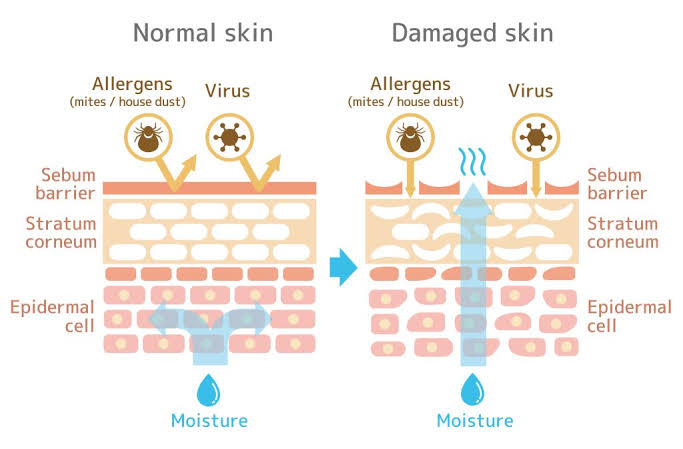 Figure 2: Skin barrier function — Healthy skin with intact sebum film vs Damaged barrier allowing evaporation and irritant penetration