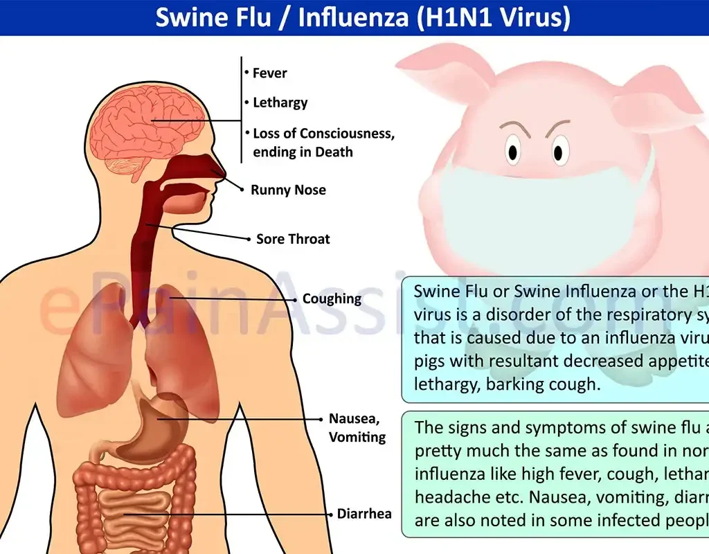 Swine Flu