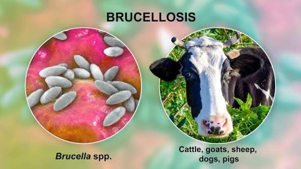 brucellosis