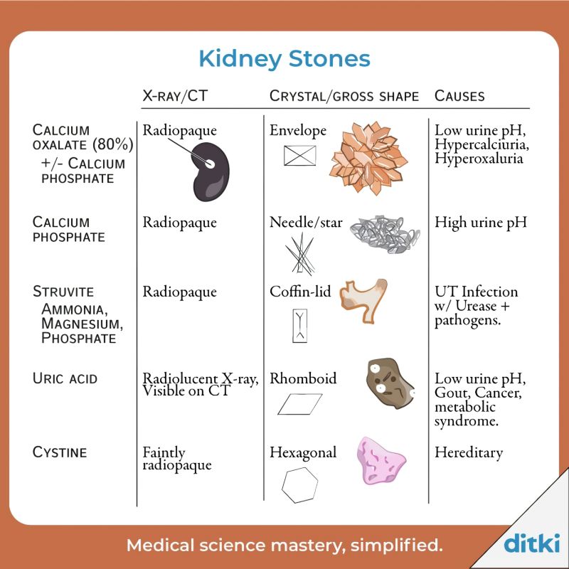 Figure 3: Comparison of Kidney Stone types, X-ray appearance, and crystal shapes