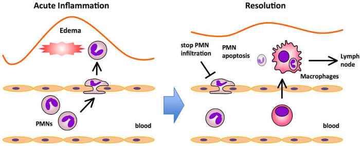 Acute Inflammation