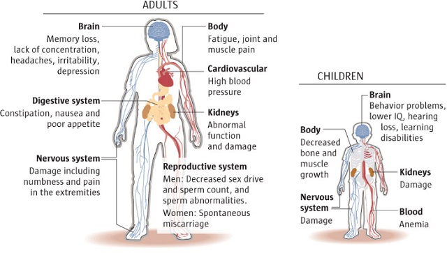 Anatomical diagram summarizing the multiorgan pathological features of lead poisoning in adults and children