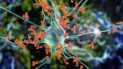Autoimmune antibody binding to neuronal cell