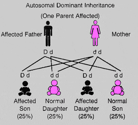 Autosomal Dominant Transmission Pedigree
