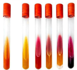 Clinical chemistry blood collection tubes with colorimetric tests